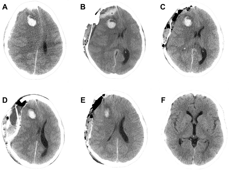 Fig 2