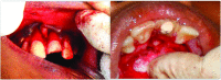 [Table/Fig-2a,b]: