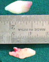[Table/Fig-3]: