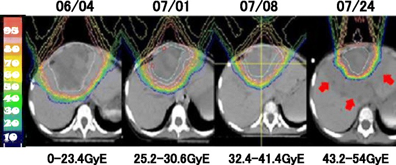 Fig. 2