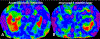 Fig. 11.