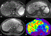 Fig. 25.
