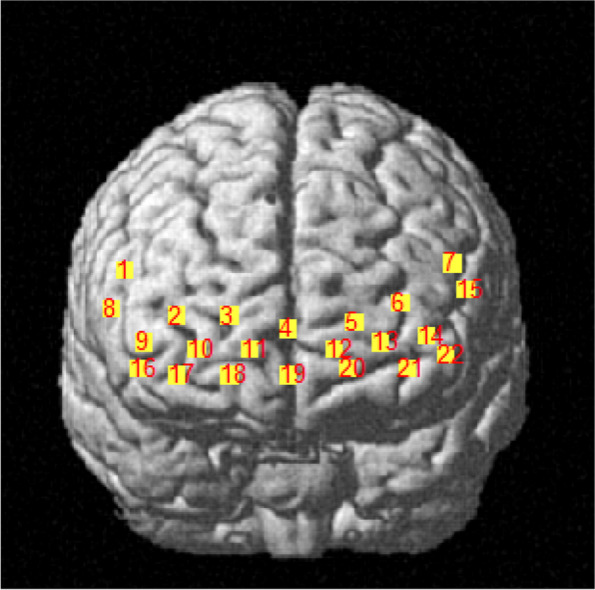 Fig. 1