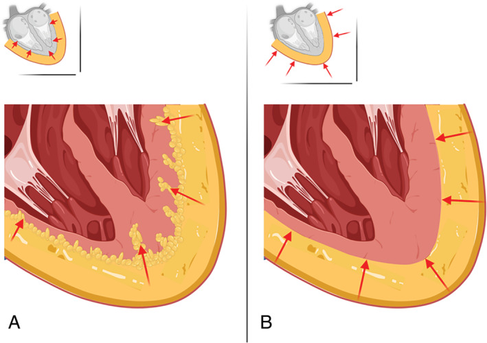 EJHF-2741-FIG-0002-c