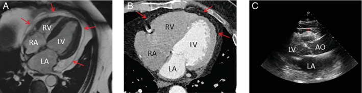 EJHF-2741-FIG-0004-c