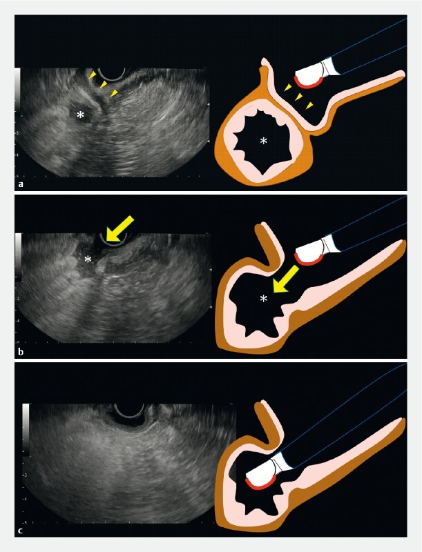 Fig. 2