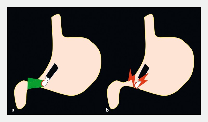 Fig. 1