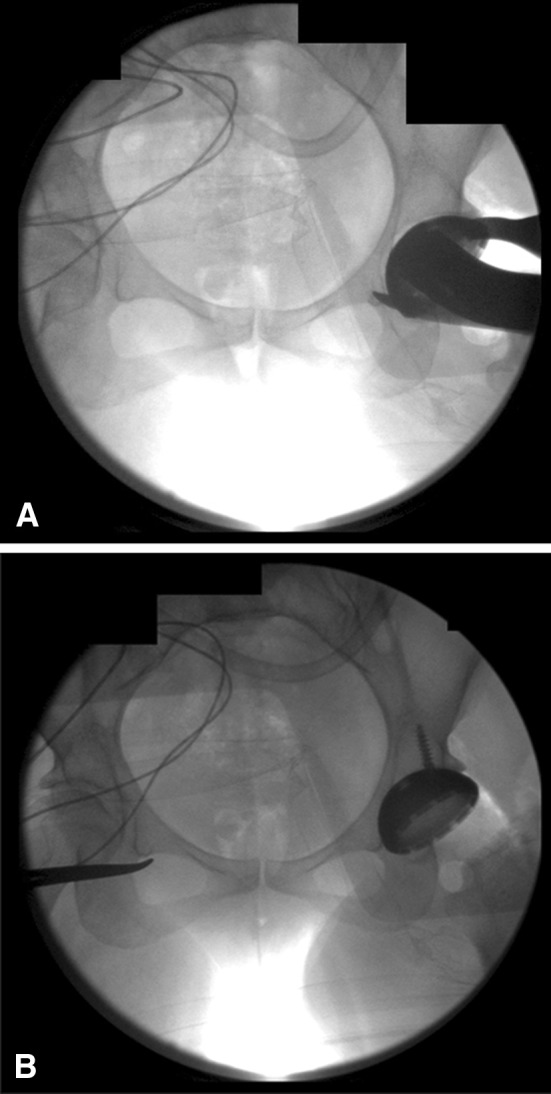 Fig. 3A–B