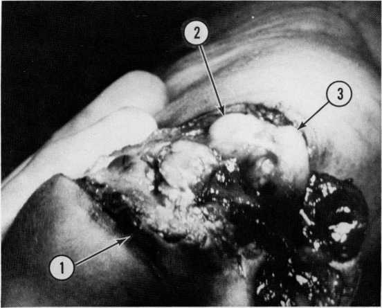 FIG. 8