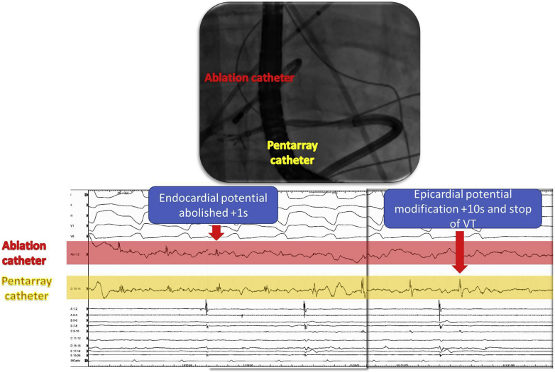 Figure 5