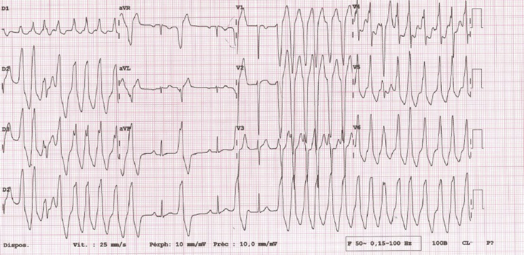 Figure 1