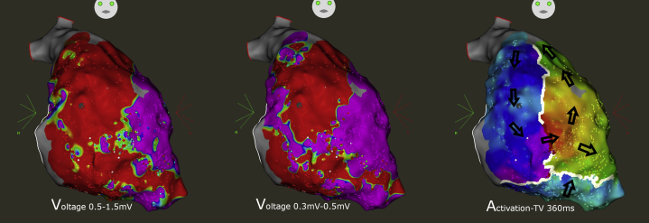 Figure 9