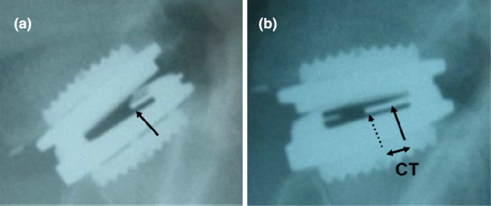 Fig. 3