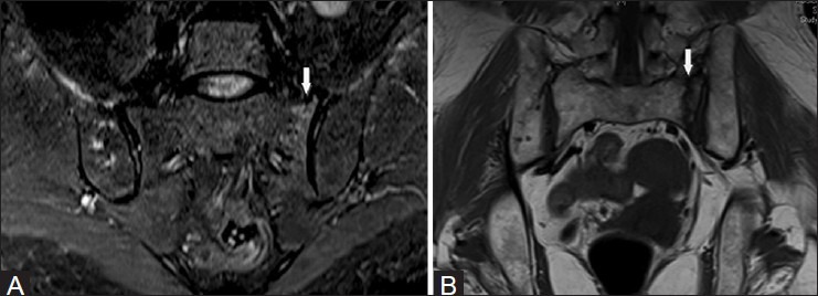 Figure 16 (A and B)