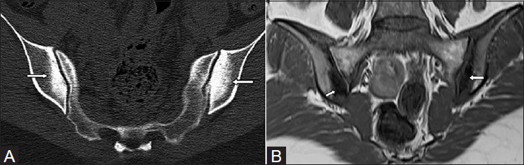 Figure 14 (A and B)