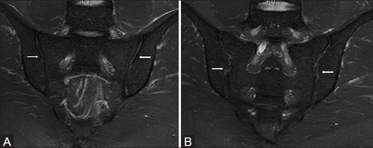 Figure 1 (A and B)