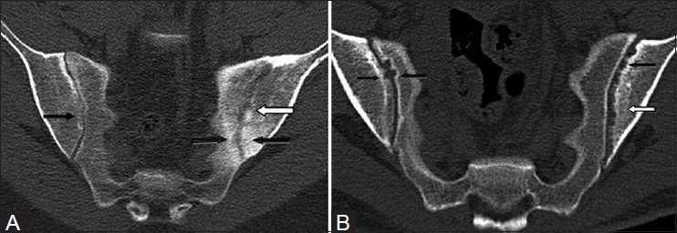 Figure 5 (A and B)