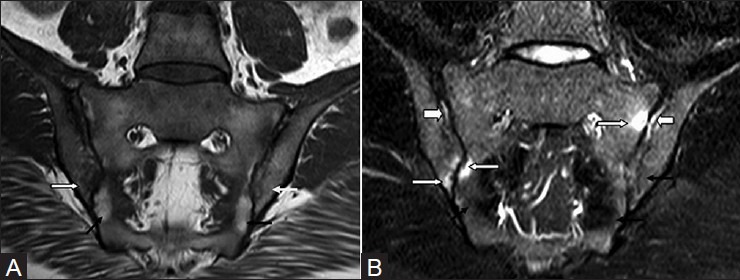 Figure 10 (A and B)