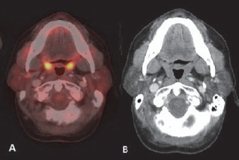 Figure 21