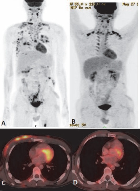 Figure 18