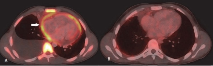 Figure 16