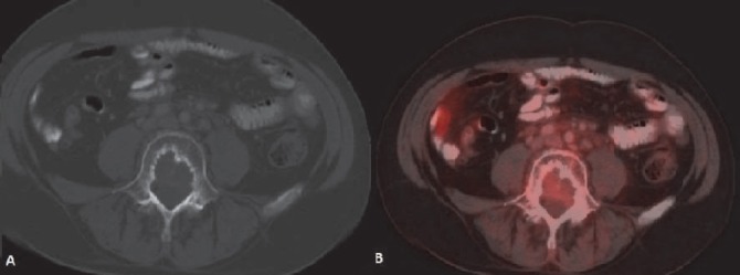 Figure 22