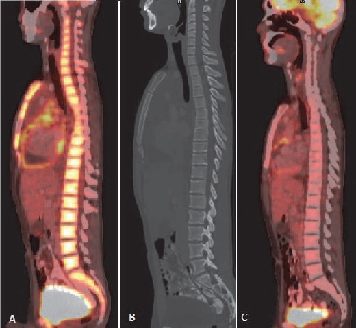 Figure 23