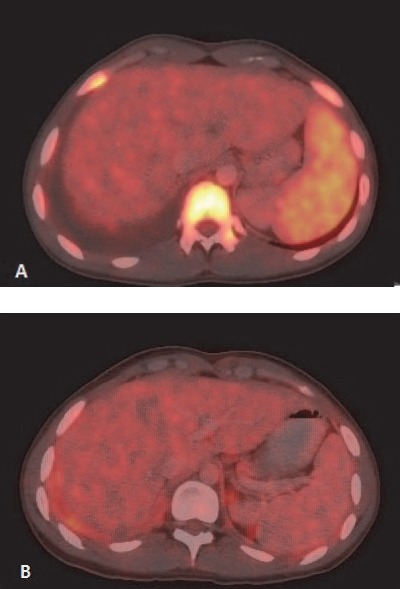 Figure 9