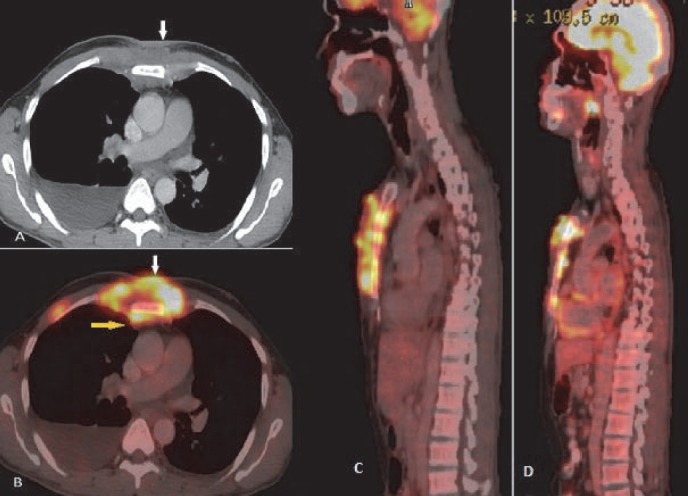 Figure 15