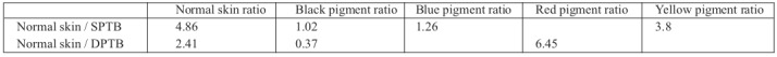 Table II