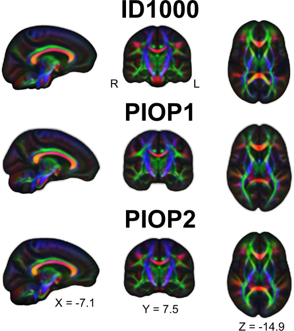 Fig. 11