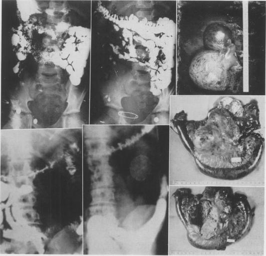 Fig. 1 (upper left)., Fig. 2 (upper center)., Fig. 3 (upper right)., Fig. 4 (lower left)., Fig. 5 (lower Center). Fig. 6 (right center). Fig. 7 (lower right).