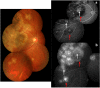 Fig. 2