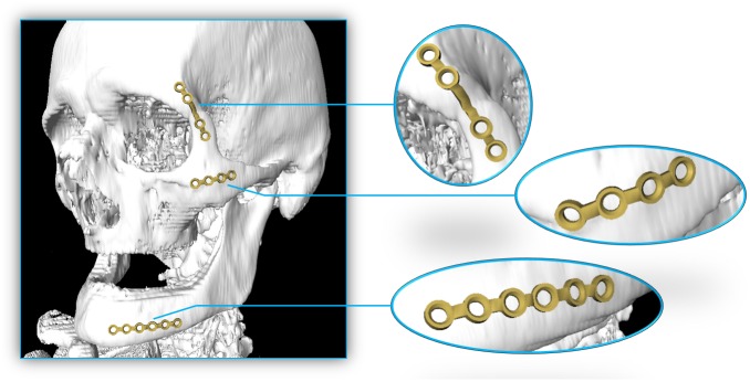 Fig 12