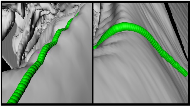 Fig 11