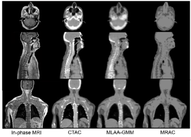 Fig. 10