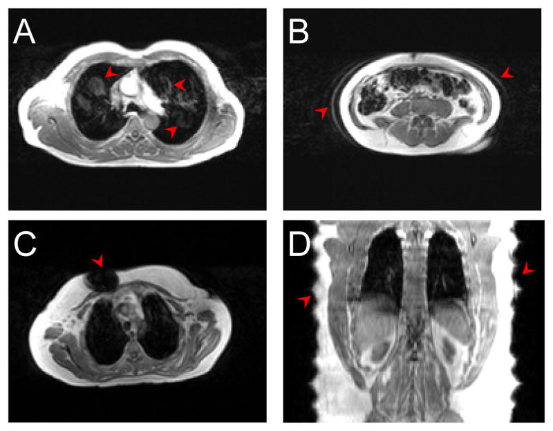 Fig. 13