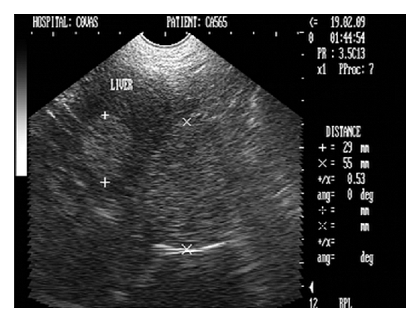 Figure 30