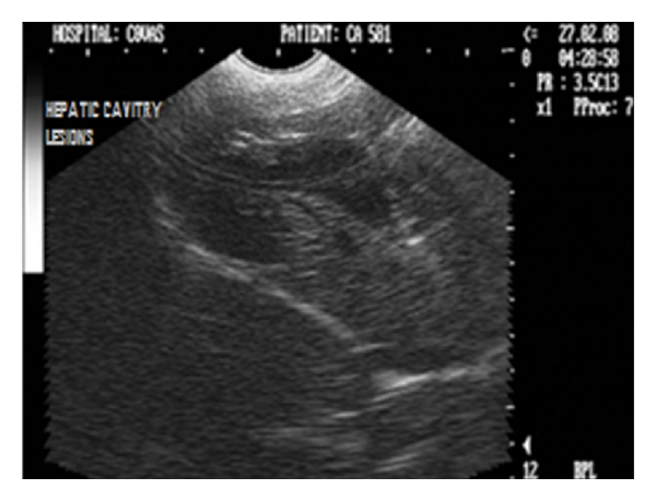 Figure 35