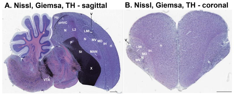 Figure 18