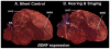 Figure 32