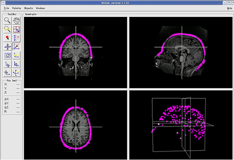 Figure 2: