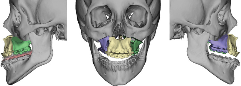 Fig. 7.