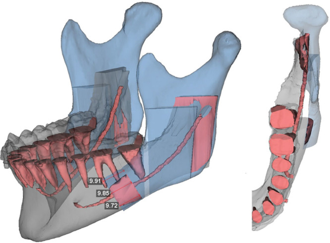 Fig. 8.