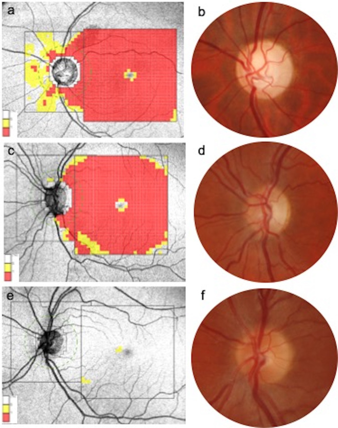 Fig. 1