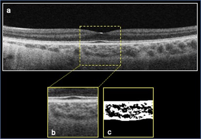 Fig. 2