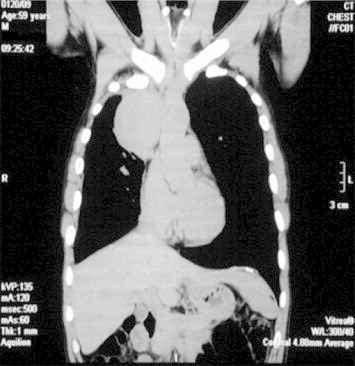 Fig. 1.1