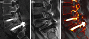 Fig. 3