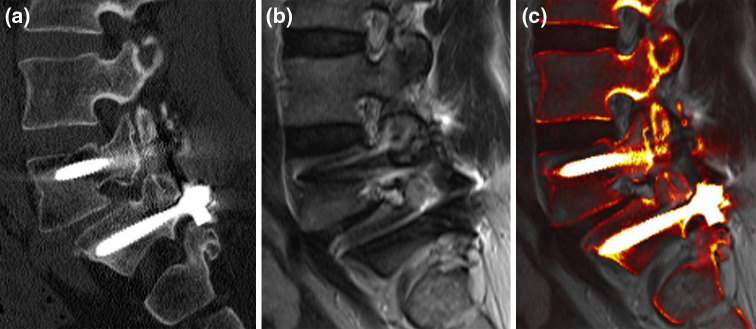 Fig. 3