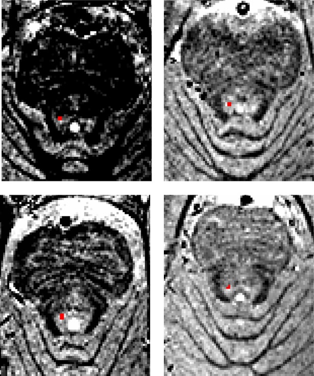 Fig 4